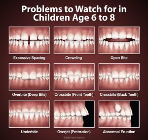 orthodontic problems