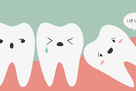 wisdom-teeth-cartoon