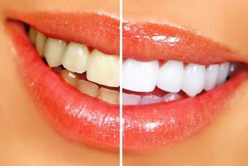 13665004854_ded7c904d8_z