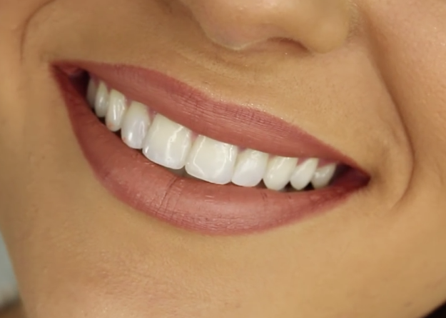 Healthy_Smiling_Teeth