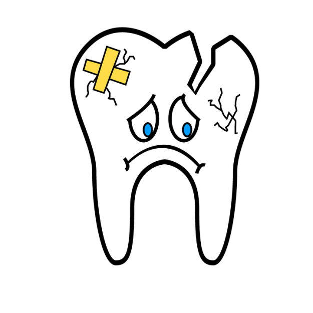 broken-tooth-2351797_960_720