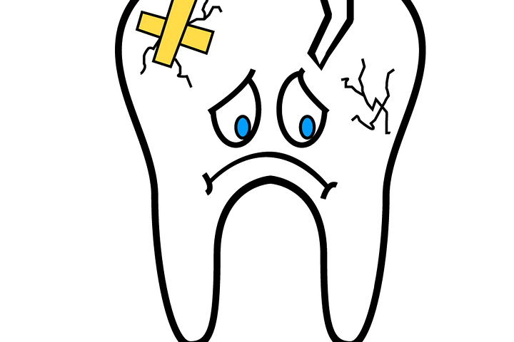broken-tooth-2351797_960_720