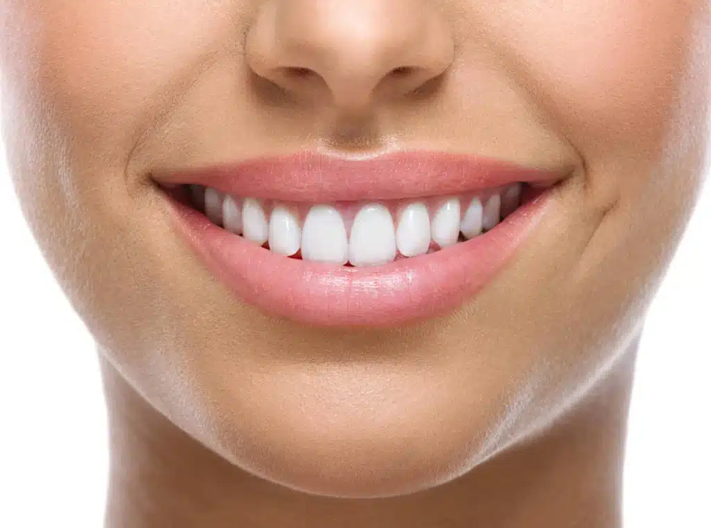 Smiling-after-teeth-whitening-raleigh