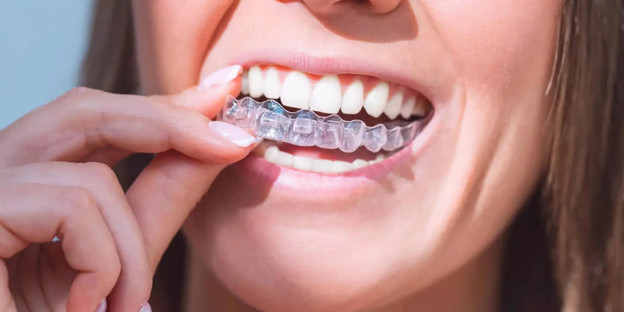 Woman-putting-invisalign-raleigh-nc Woman putting invisalign raleigh nc