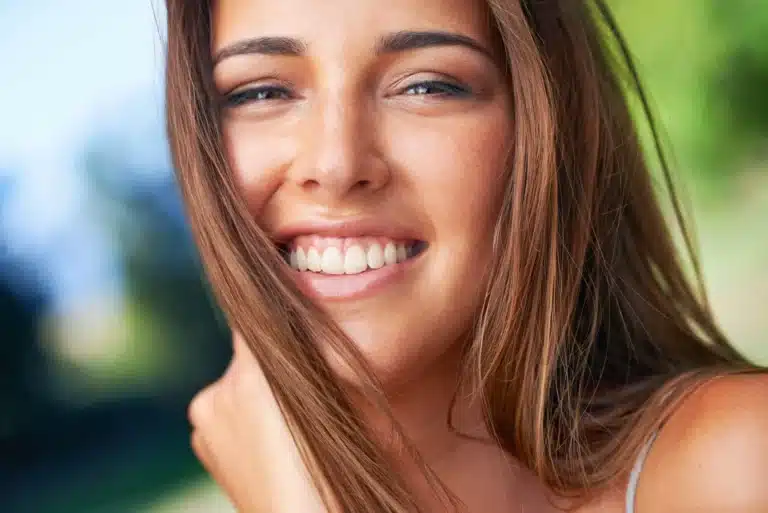 after-teeth-whitening-raleigh