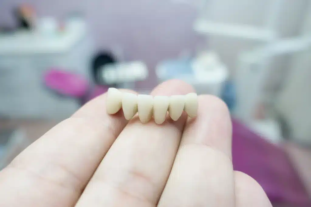 dental-crowns-raleigh